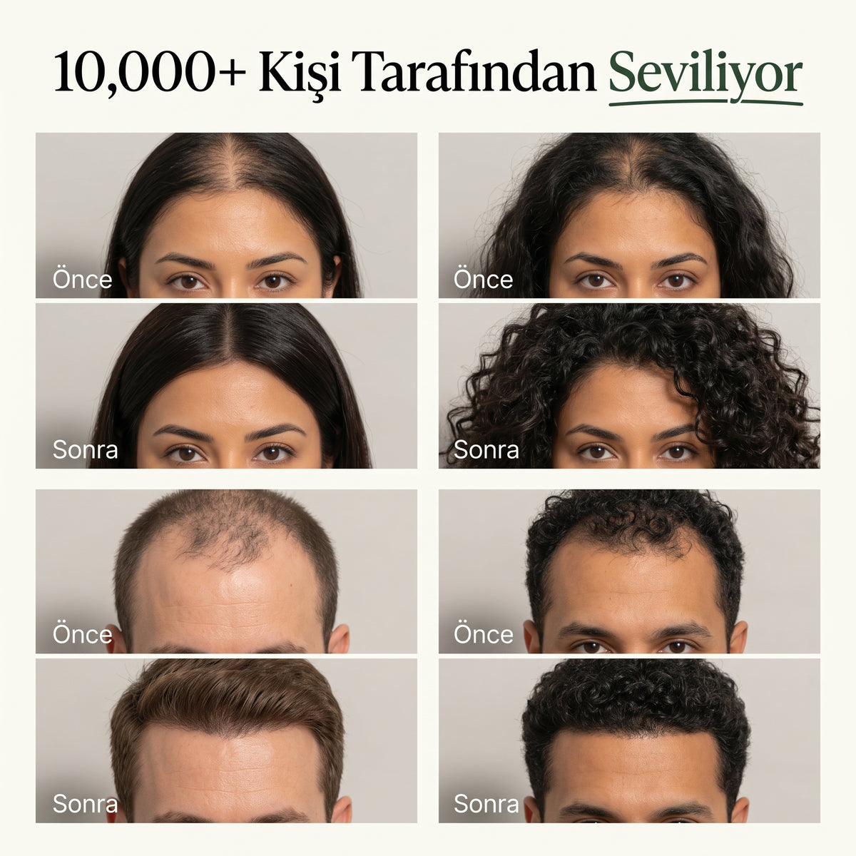 Kore Saç Derisi Canlandırıcı Bar